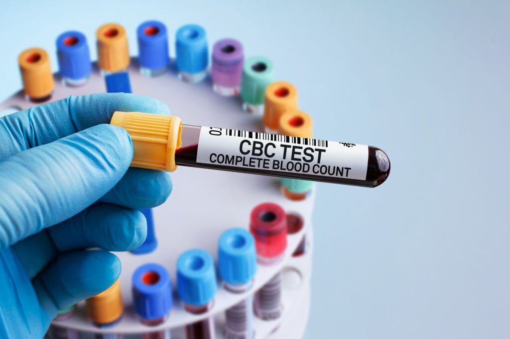 CBC Test Price in Bangladesh Full Details
